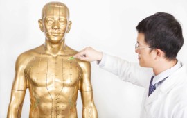 דיקור סיני. כל מה שצריך לדעת על השיטה הטבעית לריפוי הגוף דיקור סיני