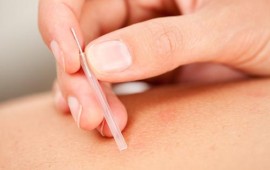 שיטות טיבעיות לטיפול במצבי מתח ולחץ רפאל רוזנסקי - מטפל בדיקור סיני