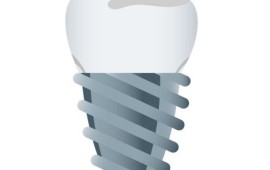 השתלת שיניים ביום אחד- מדוע וכיצד האפשרי? השתלת שיניים